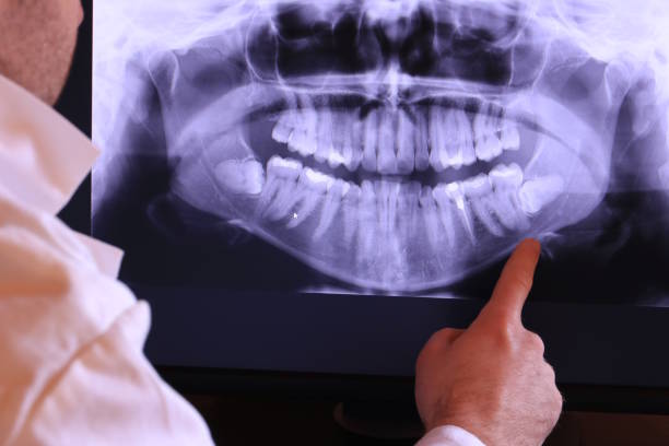Best Emergency Treatment for Toothache in Perry, IA