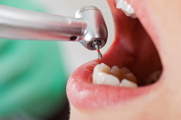 Best Emergency Treatment for Toothache in Perry, IA